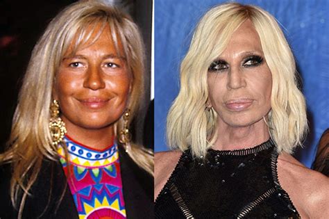 donatella versace e il lifting|Le star prima e dopo la chirurgia: la trasformazione di Donatella .